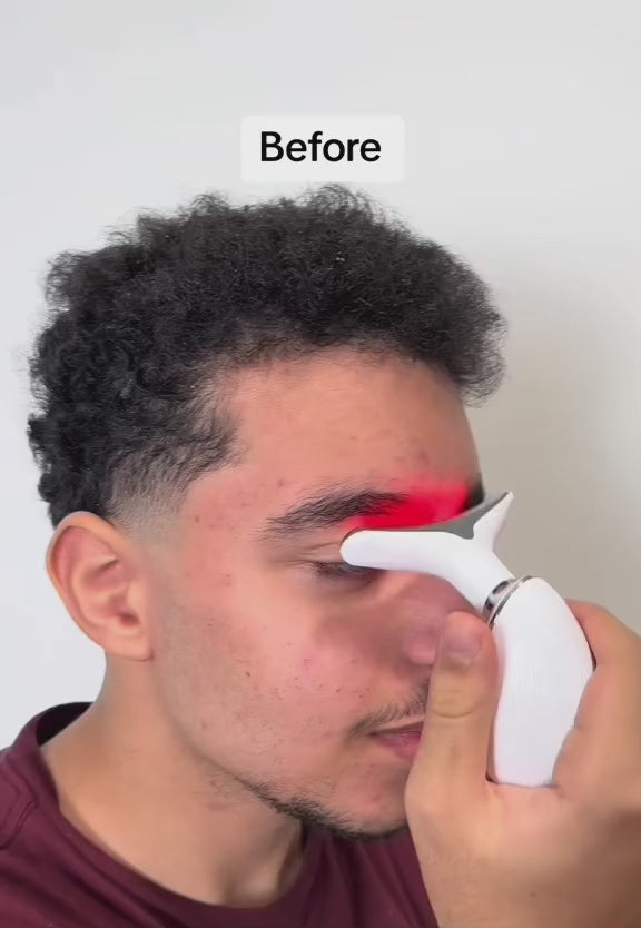 Luxe Facial Sculpter™ video